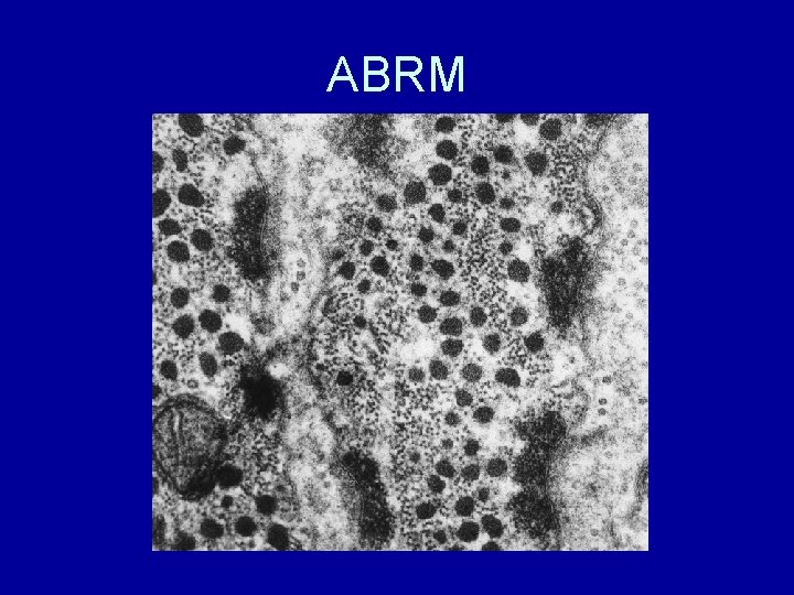 ABRM 