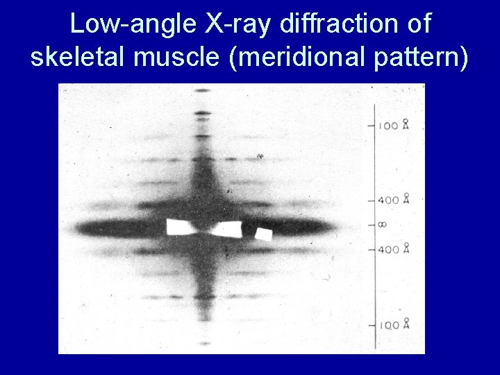 Low-angle X-ray diffraction of skeletal muscle (meridional pattern) 