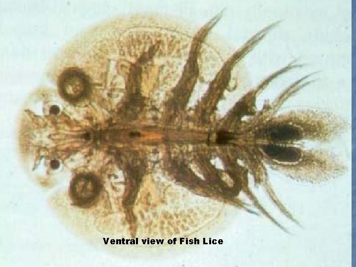 Ventral view of Fish Lice 