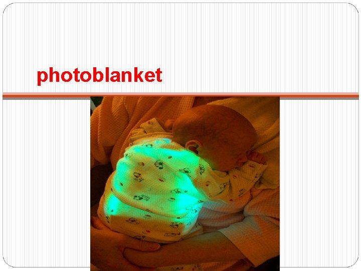 photoblanket 