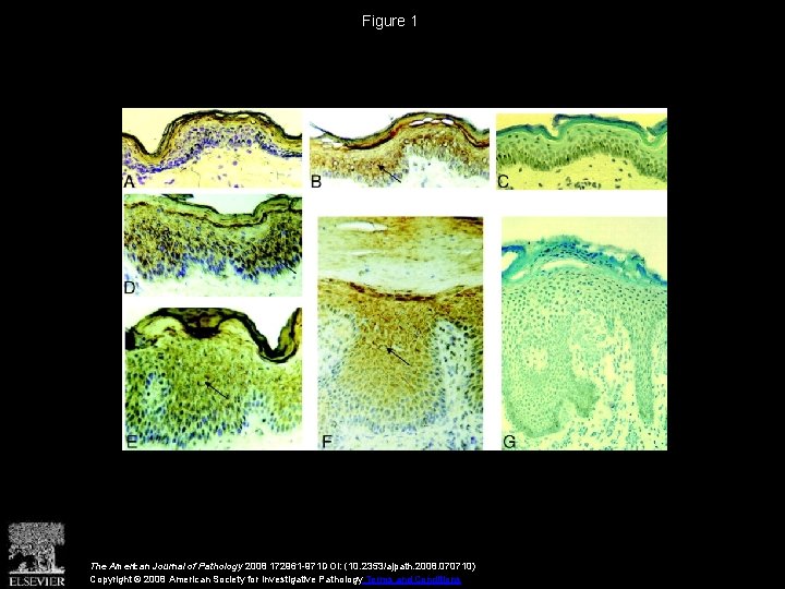 Figure 1 The American Journal of Pathology 2008 172961 -971 DOI: (10. 2353/ajpath. 2008.