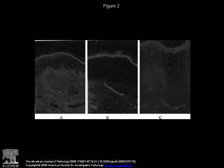 Figure 2 The American Journal of Pathology 2008 172961 -971 DOI: (10. 2353/ajpath. 2008.