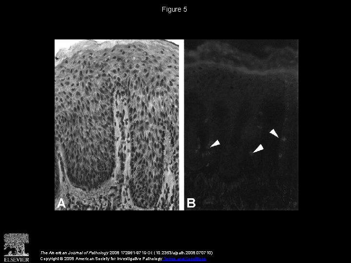 Figure 5 The American Journal of Pathology 2008 172961 -971 DOI: (10. 2353/ajpath. 2008.