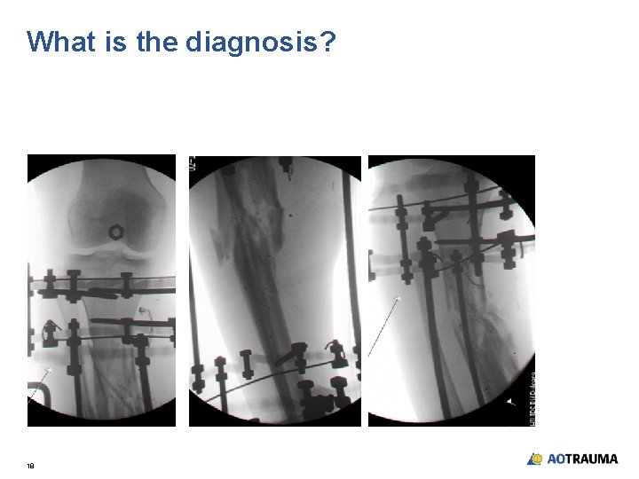 What is the diagnosis? 18 