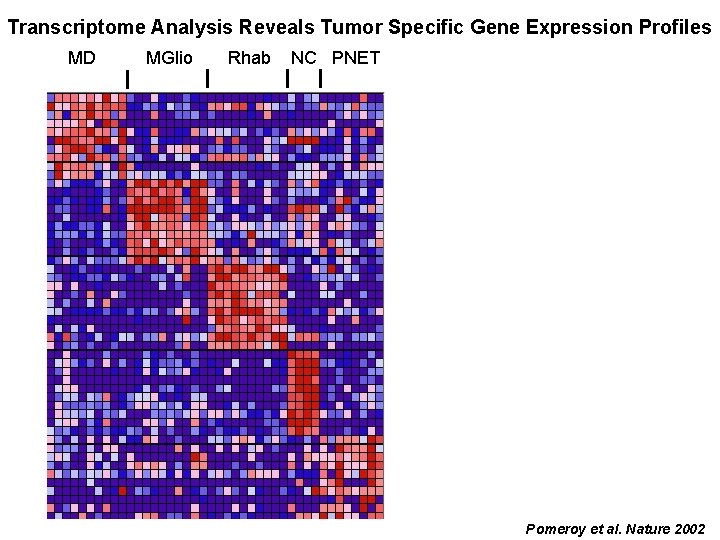 Transcriptome Analysis Reveals Tumor Specific Gene Expression Profiles MD MGlio Rhab NC PNET Pomeroy