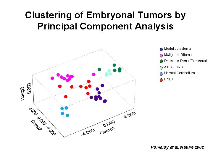 Clustering of Embryonal Tumors by Principal Component Analysis Medulloblastoma Malignant Glioma Rhabdoid Renal/Extrarenal AT/RT