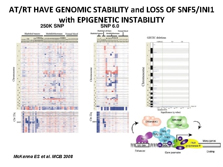 AT/RT HAVE GENOMIC STABILITY and LOSS OF SNF 5/INI 1 with EPIGENETIC INSTABILITY Mc.