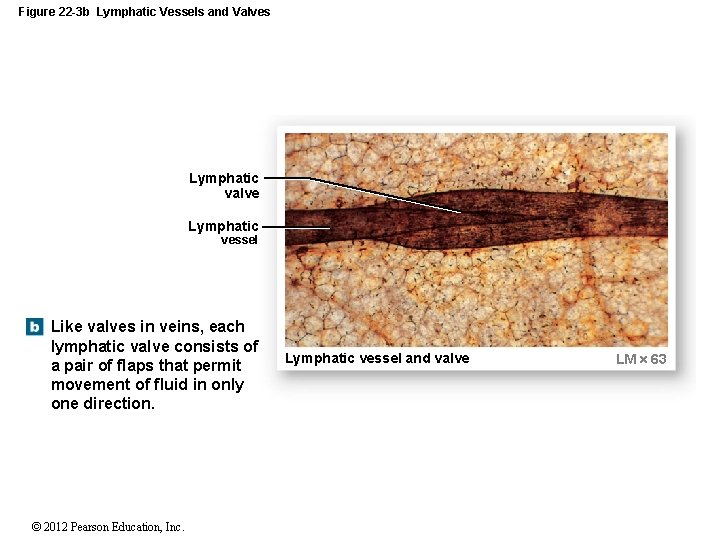 Figure 22 -3 b Lymphatic Vessels and Valves Lymphatic valve Lymphatic vessel Like valves