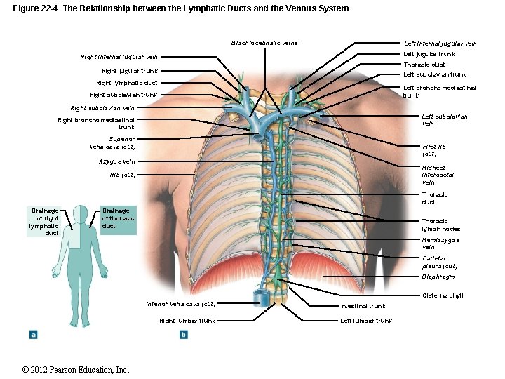 Figure 22 -4 The Relationship between the Lymphatic Ducts and the Venous System Brachiocephalic