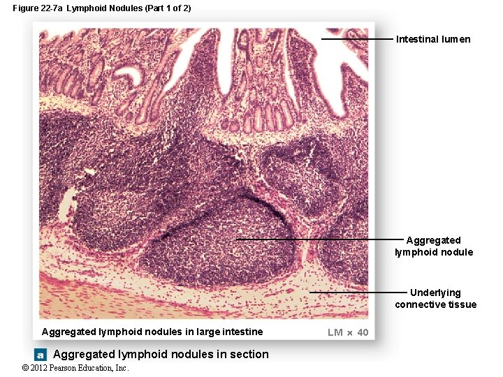 Figure 22 -7 a Lymphoid Nodules (Part 1 of 2) Intestinal lumen Aggregated lymphoid
