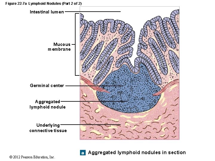 Figure 22 -7 a Lymphoid Nodules (Part 2 of 2) Intestinal lumen Mucous membrane