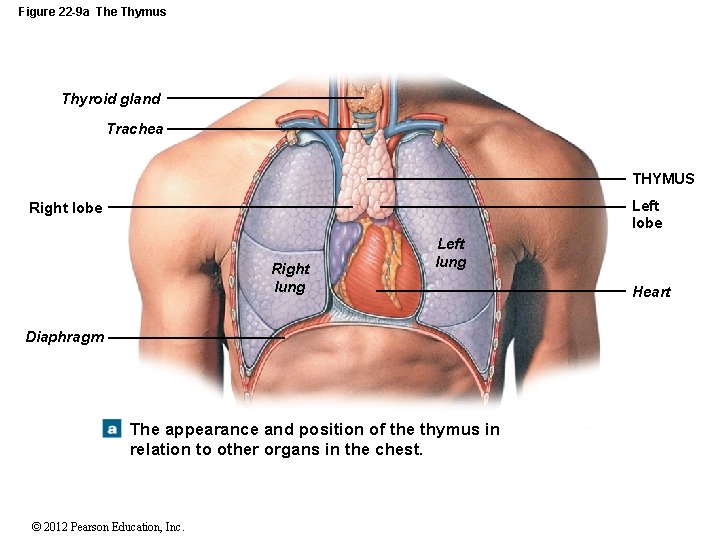 Figure 22 -9 a The Thymus Thyroid gland Trachea THYMUS Left lobe Right lung
