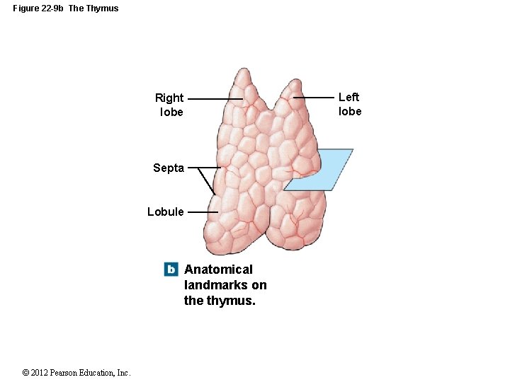 Figure 22 -9 b The Thymus Left lobe Right lobe Septa Lobule Anatomical landmarks
