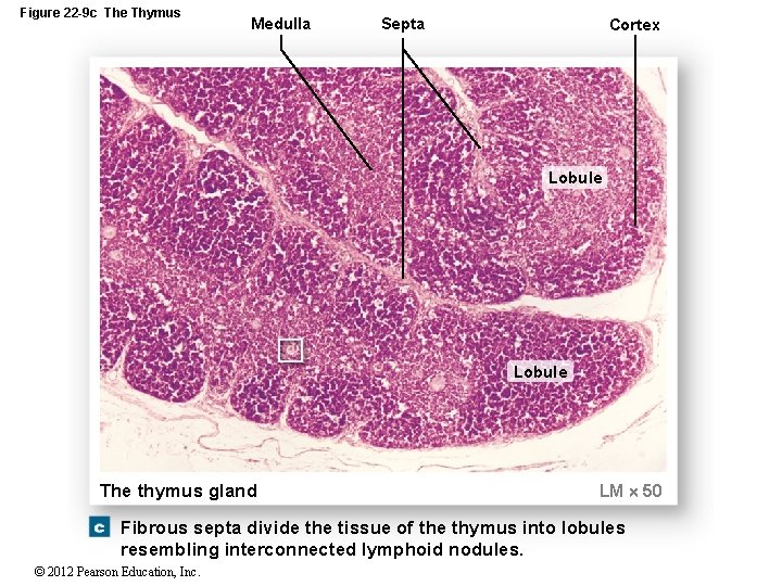Figure 22 -9 c The Thymus Medulla Septa Cortex Lobule The thymus gland LM
