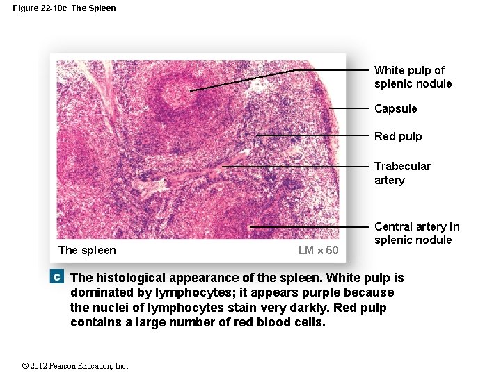 Figure 22 -10 c The Spleen White pulp of splenic nodule Capsule Red pulp