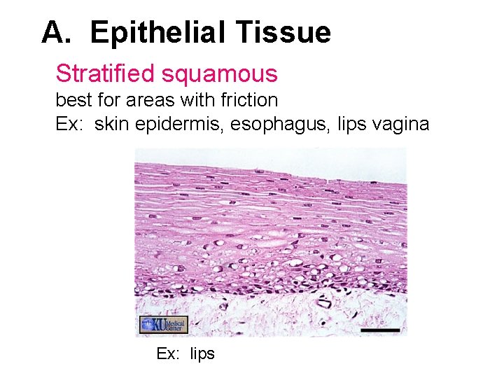 A. Epithelial Tissue Stratified squamous best for areas with friction Ex: skin epidermis, esophagus,