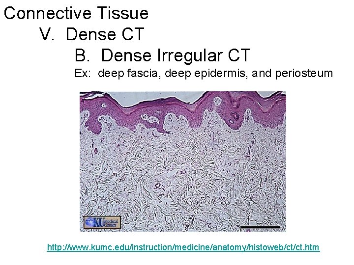 Connective Tissue V. Dense CT B. Dense Irregular CT Ex: deep fascia, deep epidermis,