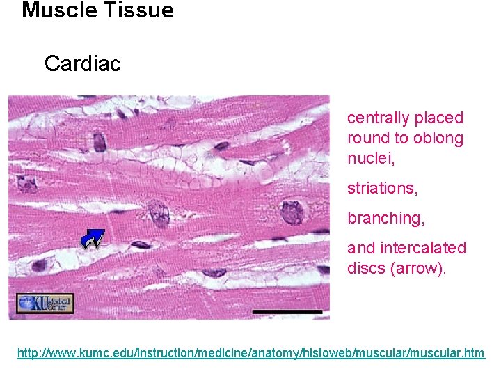 Muscle Tissue Cardiac centrally placed round to oblong nuclei, striations, branching, and intercalated discs