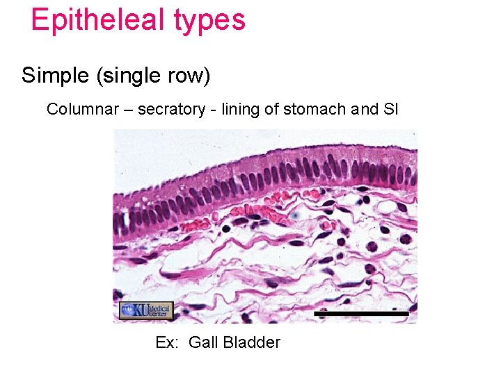 Epitheleal types Simple (single row) Columnar – secratory - lining of stomach and SI