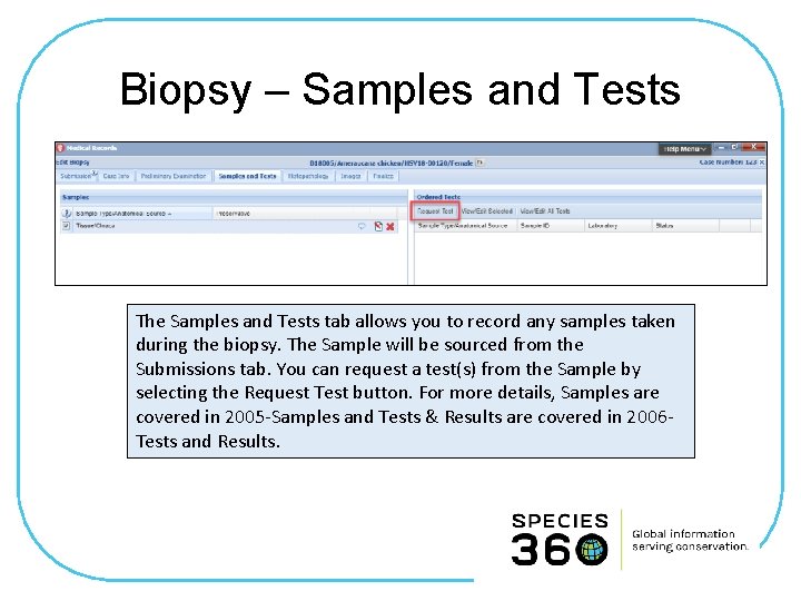 Biopsy – Samples and Tests The Samples and Tests tab allows you to record