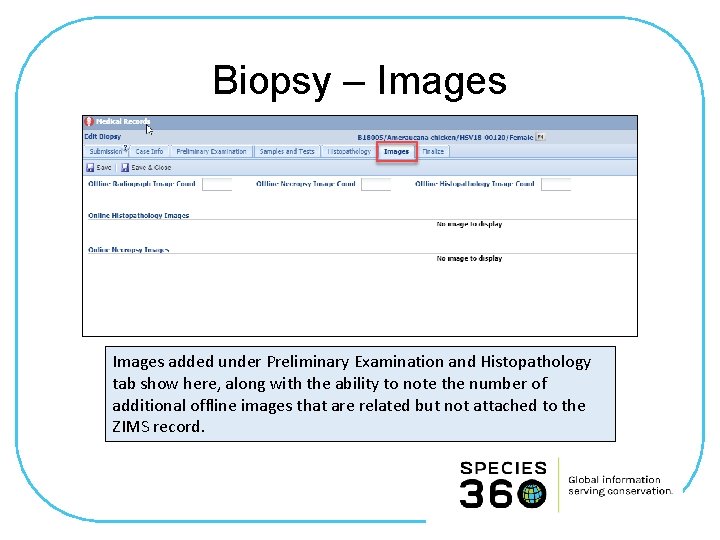 Biopsy – Images added under Preliminary Examination and Histopathology tab show here, along with