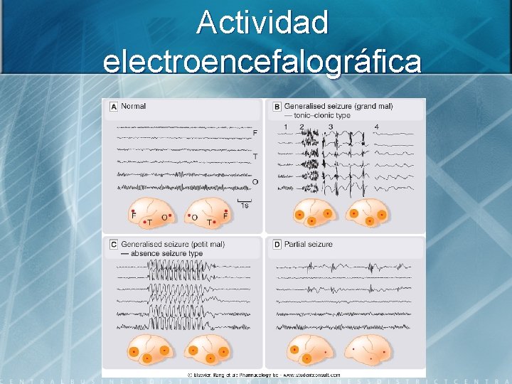 Actividad electroencefalográfica 