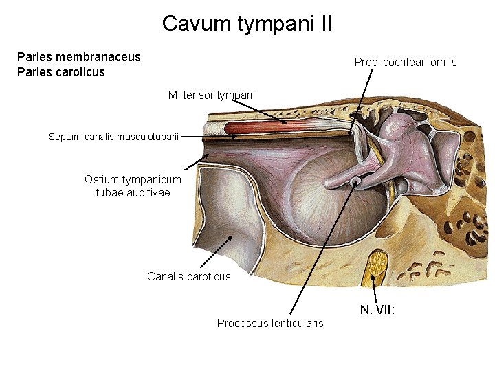 Cavum tympani II Paries membranaceus Paries caroticus Proc. cochleariformis M. tensor tympani Septum canalis
