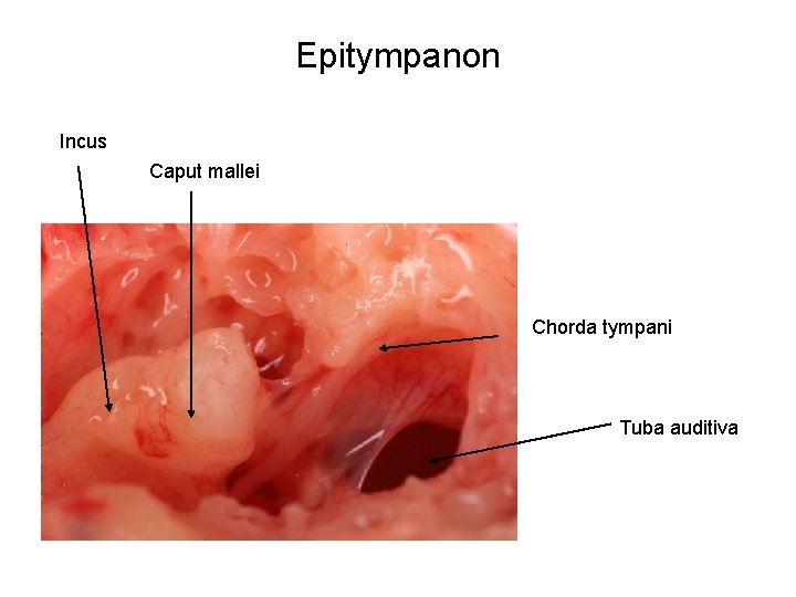 Epitympanon Incus Caput mallei Chorda tympani Tuba auditiva 