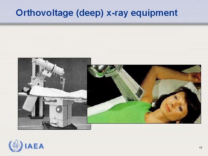 Orthovoltage (deep) x-ray equipment IAEA 17 