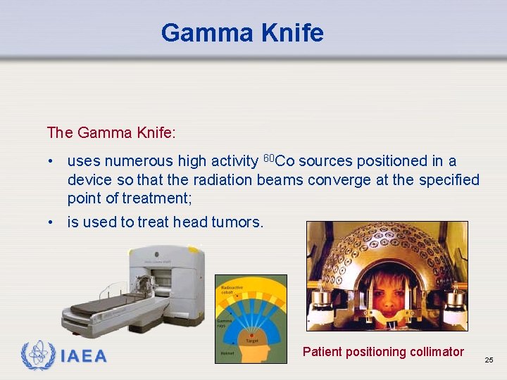 Gamma Knife The Gamma Knife: • uses numerous high activity 60 Co sources positioned