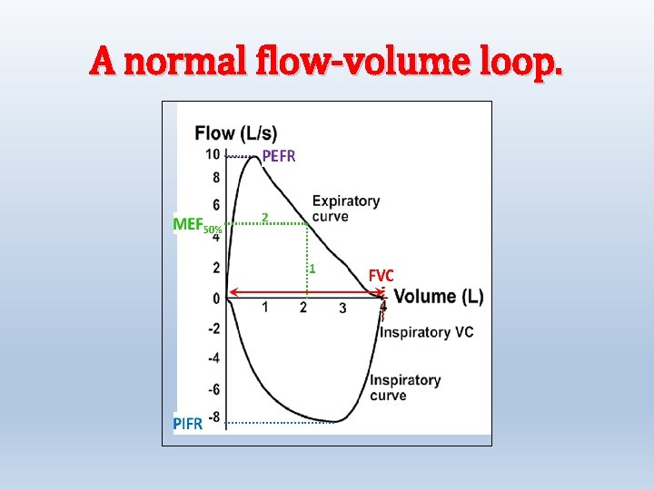 A normal flow-volume loop. 