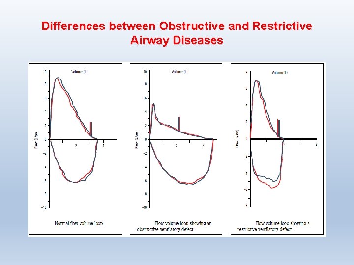 Differences between Obstructive and Restrictive Airway Diseases 