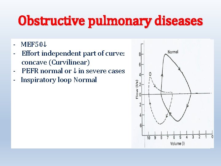 Obstructive pulmonary diseases - MEF 50↓ - Effort independent part of curve: concave (Curvilinear)
