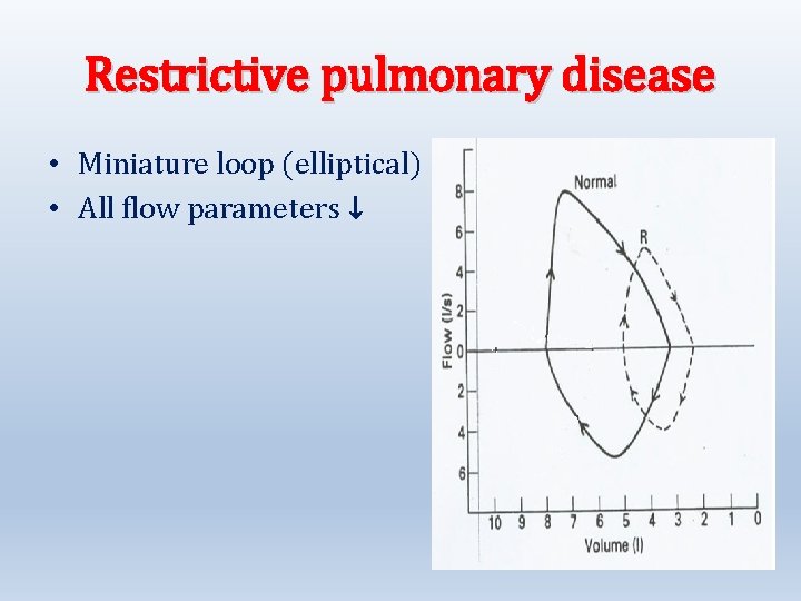 Restrictive pulmonary disease • Miniature loop (elliptical) • All flow parameters ↓ 