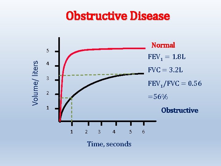 Obstructive Disease Normal Volume/ liters 5 FEV 1 = 1. 8 L 4 FVC