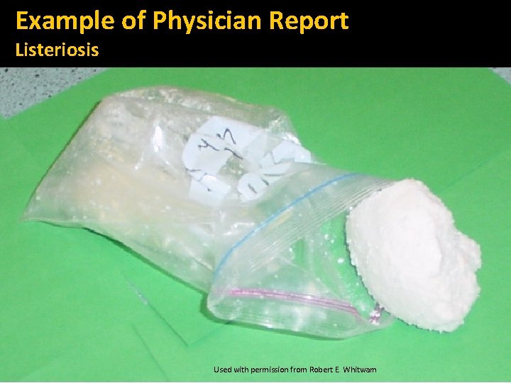 Example of Physician Report Listeriosis Used with permission from Robert E. Whitwam 