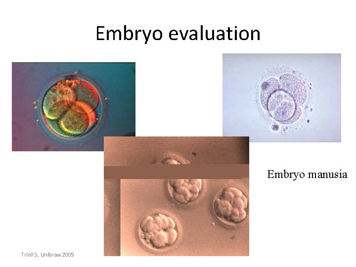 Embryo evaluation Embryo manusia Trinil S, Unibraw 2005 