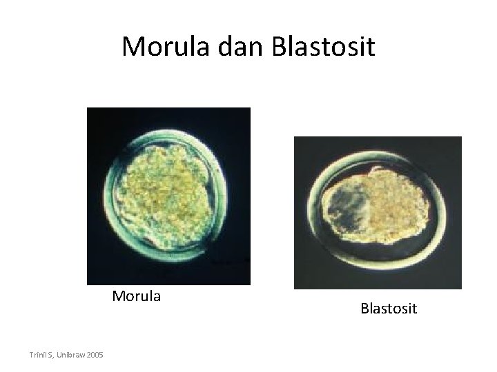 Morula dan Blastosit Morula Trinil S, Unibraw 2005 Blastosit 