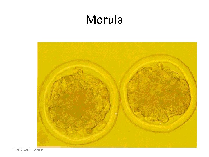 Morula Trinil S, Unibraw 2005 