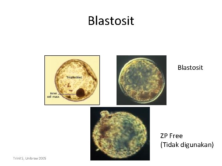 Blastosit ZP Free (Tidak digunakan) Trinil S, Unibraw 2005 
