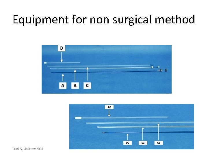 Equipment for non surgical method Trinil S, Unibraw 2005 