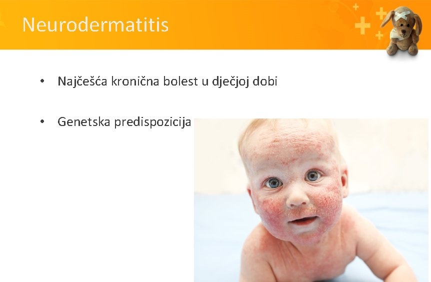 Neurodermatitis • Najčešća kronična bolest u dječjoj dobi • Genetska predispozicija 
