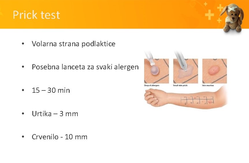 Prick test • Volarna strana podlaktice • Posebna lanceta za svaki alergen • 15