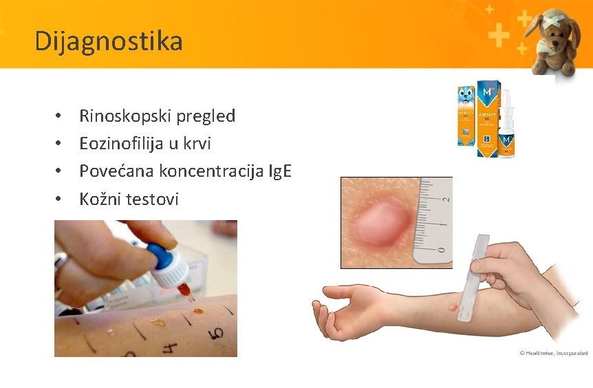 Dijagnostika • • Rinoskopski pregled Eozinofilija u krvi Povećana koncentracija Ig. E Kožni testovi