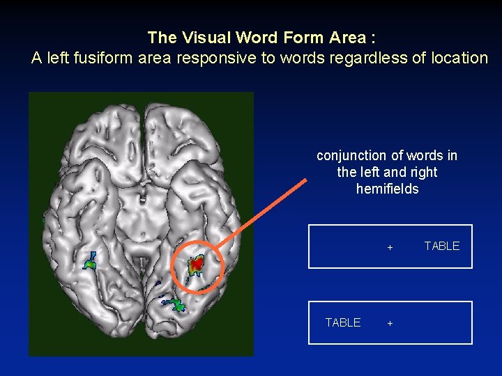The Visual Word Form Area : A left fusiform area responsive to words regardless