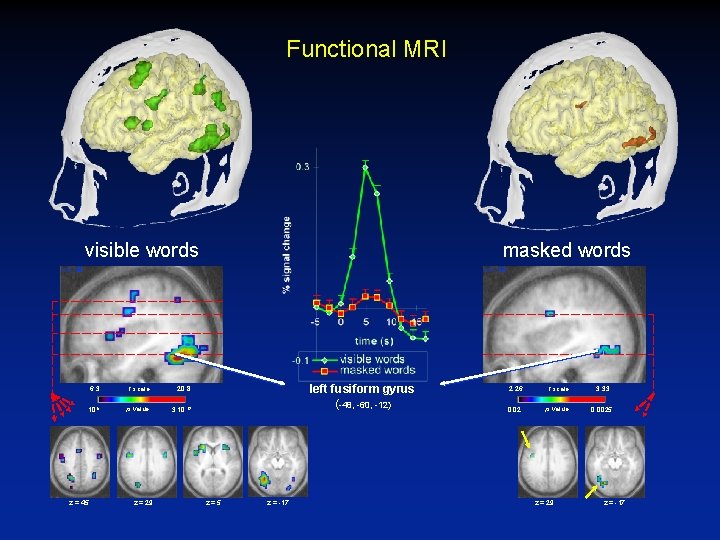 Functional MRI visible words masked words x = -38 6. 3 t scale 20.