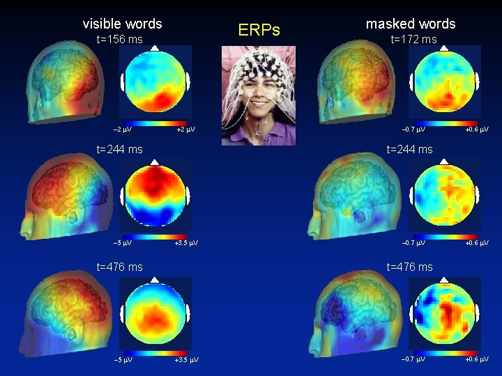 visible words ERPs t=156 ms -2 m. V +2 m. V t=244 ms -5