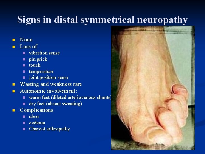 Signs in distal symmetrical neuropathy n n None Loss of n n n n