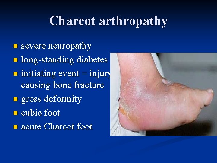 Charcot arthropathy severe neuropathy n long-standing diabetes n initiating event = injury, causing bone