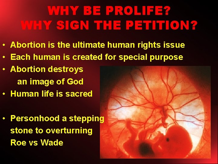 WHY BE PROLIFE? WHY SIGN THE PETITION? • Abortion is the ultimate human rights